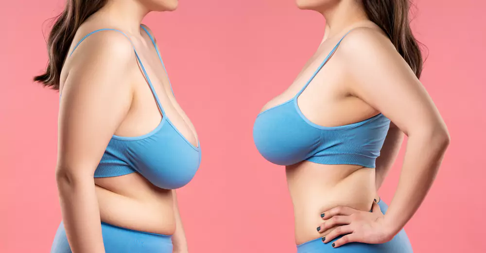 breast reduction surgery at dr sagar daiv asthetic clinic